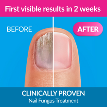 Load image into Gallery viewer, Excilor Solution with Brush for Nail Fungus Treatment 3.3ml