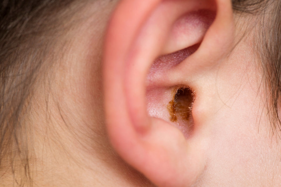 How can I remove an earwax plug?